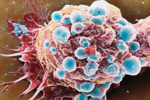 Какие органы человека больше всего подвержены раковым заболеваниям?
