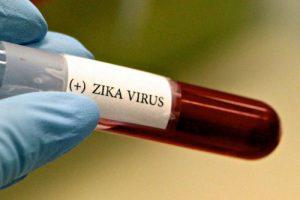 Азербайджан готов к проверке крови на вирус Зика