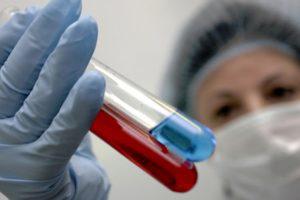 В Азербайджане выявили новых больных сифилисом, СПИДом