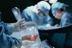 Трансплантации органов в Азербайджане — быть