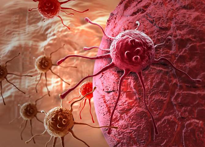onkologia-rak-cancer-med